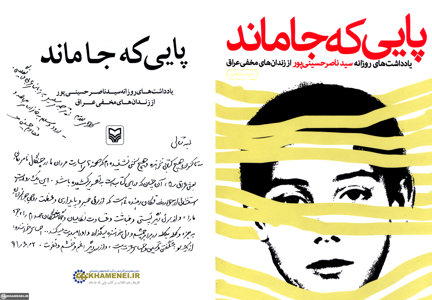 "پايي که جا ماند"