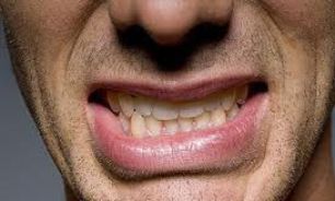 پایان دندان قروچه با روشی جدید
