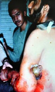 مهمان حبیب خداست حتی اگر خمپاره 60 باشد