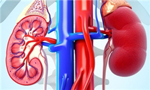50 بیمار کلیوی در البرز در انتظار پیوند هستند