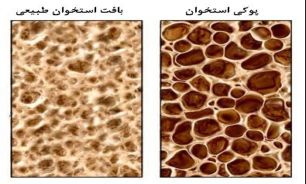 بذر بیماری تمدن از چه سنی نشانده می شود؟
