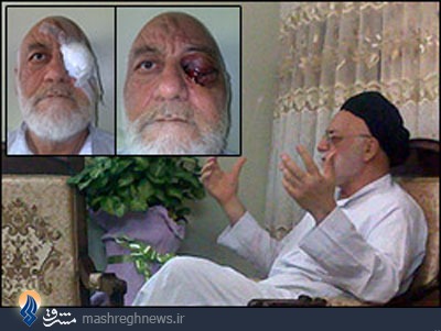 پزشکان مجبور شدند چشمم را تخلیه کنند/ از مسئولین مربوطه گلایه دارم/ تا یک ماه اجازه رسانه‌ای شدن ماجرا را ندادم/ اگر بدانم ضارب توبه کرده است او را می‌بخشم