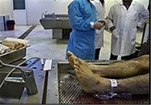 برخورد با پزشکان متخلف فروش اعضای بدن سطحی نباشد