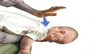 کمک‌های اولیه برای خارج کردن شی از گلوی کودک + آموزش