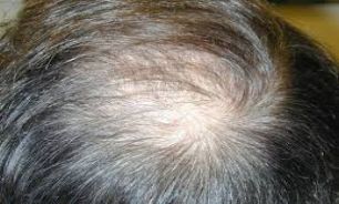 شادابی و شفافیت موهایتان را با این وسیله از بین نبرید