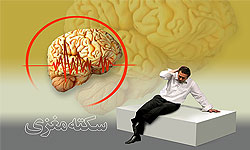 در هنگام سکته مغزی چه باید کرد؟