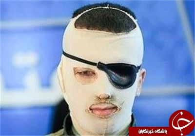 خودداری پزشکان از اجرای حکم قصاص اسیدپاشی باید به اطلاع رئیس قوه‌قضاییه برسد