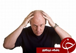 با این روش درمانی در آینده دور مشکل طاسی را خط بکشید