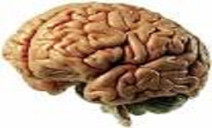 دکمه تنظیم مجدد مغز کجاست؟