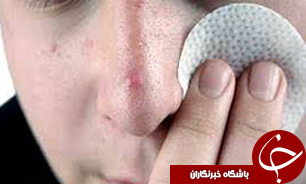 با غلبه بر این مشکل از عارضه‌های پوستی پیشگیری کنید