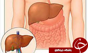 اغلب موارد کبد چرب ناشی از این دو عامل است