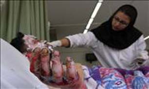 مراکز درمانی کشور زیر بار درمان سوختگی نمی‌روند