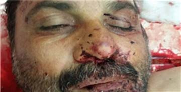 عامل اصلی کشتار شیعیان در "پاکستان" که بود؟