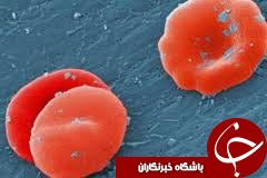 رابطه کلسترول خون و سرطان پروستات