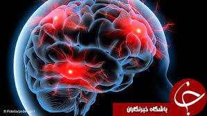 آیا می‌دانید آلودگی هوا ترکیبات مغز را تغییر می‌دهد؟