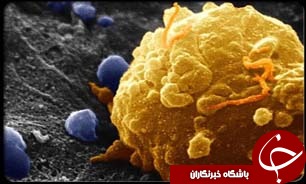 افزایش 35 درصدی سرطان تا سال 2025/ مقابله با سرطان را در حرف‌ها و تئوری‌هایمان درست اجرا نکردیم