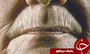 عواملی که باعث نابودی پوست می‌شود