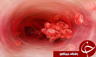 علایم لوسمی را با علایم سایر بیماری‌ها اشتباه نگیرید
