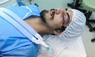 چهارشنبه سوری امسال 22 قطع عضو به همراه داشت/ 2 قربانی نابینا شدند