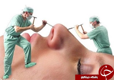 نکاتی مهم درباره جراحی بینی