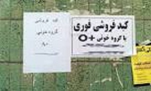 مردی که اعضاي بدنش را به مزايده گذاشت!