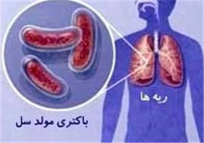 مبتلایان بیماری سل در مازندران کمتر از میانگین کشوری است