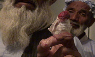 طالبان انگشت یک روحانی مسجد هرات را نیز بریدند