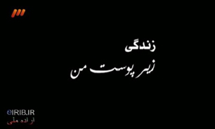 زندگي زير پوست كيسه اكسيژن