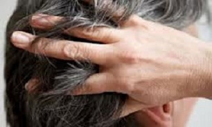 موها در تابستان چه مراقبتی می خواهند؟