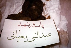 شهیدی که بعد از 9 سال از جنازه اش خون تازه چکید!