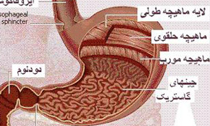 "رفلاکس معده" یکی از شایع‌ترین علل شوری دهان است