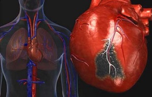 خوشمزه ترین چاشنی که قلب را از کار می اندازد