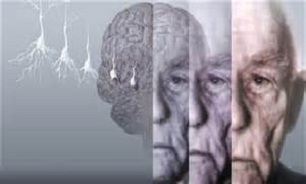 برای پیشگیری از این بیماری ورزش کنید