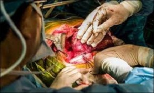 حیوانات اهداکنندگان جدید عضو به انسان