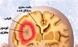 ارائه خدمات درمانی جدید به بیماران سرطانی جنوب کشور در شیراز