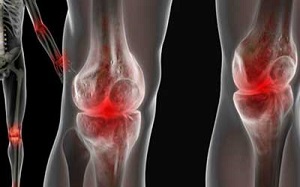 ترمیم مفصل زانو با کمک این قسمت از صورت+ عکس