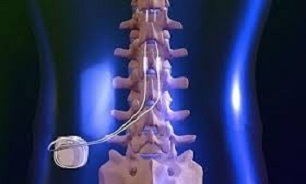 با یک حرکت ساده عضلات ستون فقرات را تقویت کنید!