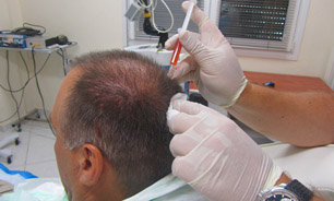 PRP از واقعیت تا یک دروغ