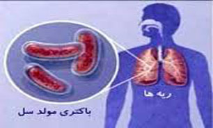 راه‌اندازی مجهزترین پایگاه مبارزه با سل/ جنوب شرقی کشور محل استقرار بزرگترین پایگاه مبارزه با سل