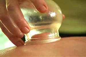 حجامت، درمانی کم هزینه و بدون عوارض