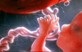 قم به تخصصی ترین مساله روز دنیا در زمینه ذخیره‌ سازی خون بند ناف دست یافت