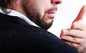 با شوره سر چه کنیم؟