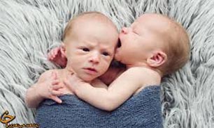 2 درصد کودکان متولد شده دچار اختلالات تکاملی هستند