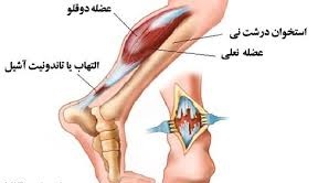 با این ترکیب التهاب را کاهش دهید