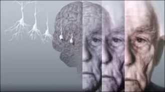 حسود و موذی هستید؟ آلزایمر می گیرید