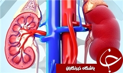 چه افرادی در معرض ابتلا به مشکلات کلیوی هستند/ مسکن‌ها و آنتی‌بیوتیک‌ها قاتلان کلیه
