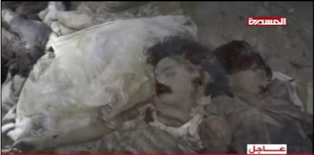 تصاویر هولناک از پیکر کودکان یمنی که در حملات وحشیانه عربستان به شهادت رسیدند