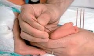 وجودبیش از 800نوزاد مبتلا به کم کاری تیرویید در کردستان