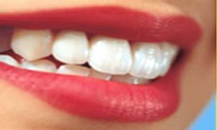 برای برق انداختن دندان در منزل چه کنیم؟