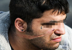اوباشی معروف به گوسفند در درگیری با پلیس پایتخت مغلوب شد